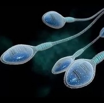 Электронная спермограмма