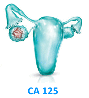 Маркер рака яичника СА 125